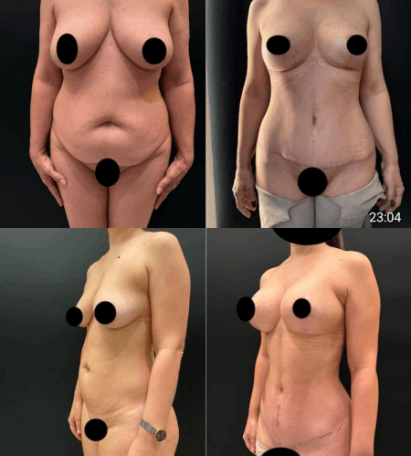 EX15